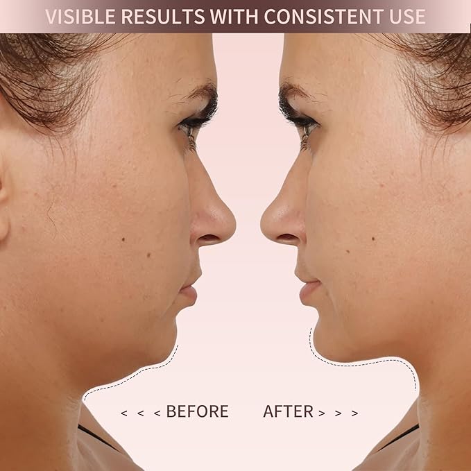 NOVASKIN™ V-Lift Mask